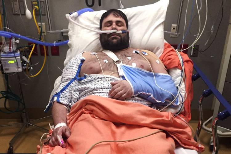In this photograph provided by Kerry Smith, Jeff Smith rests in a hospital bed on April 16, 2019, at Baystate Medical Center in Springfield after crashing his snowmobile.